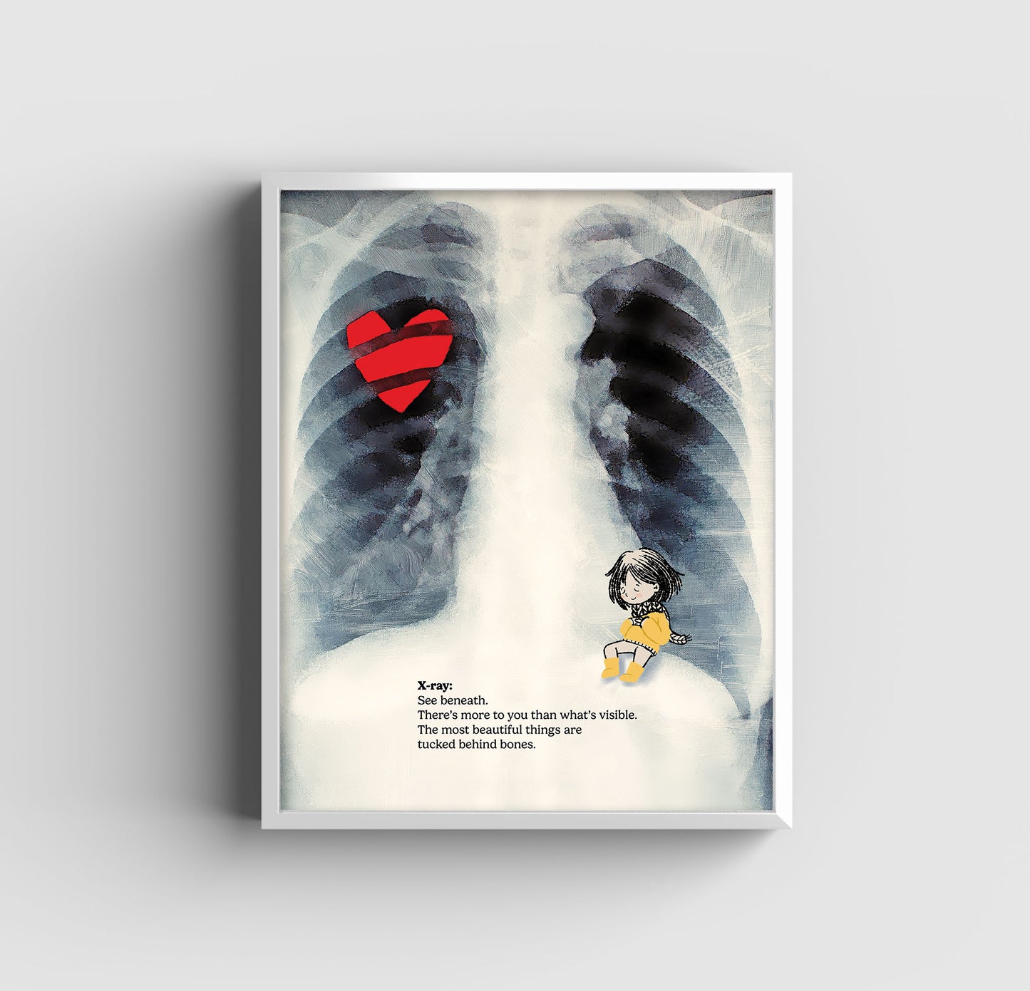 Remember Your X's - Art Print